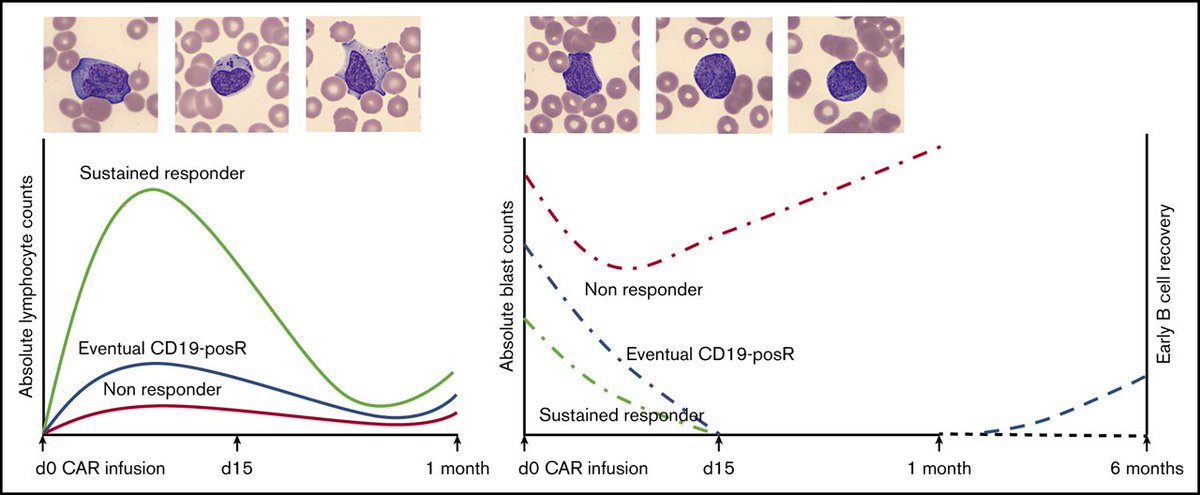 BloodAdvances's tweet photo. Absolute lymphocyte count proliferation kinetics after CAR T-cell infusion impact response and relapse https://t.co/tLOL4XrPKi https://t.co/IcEdgA9c84
