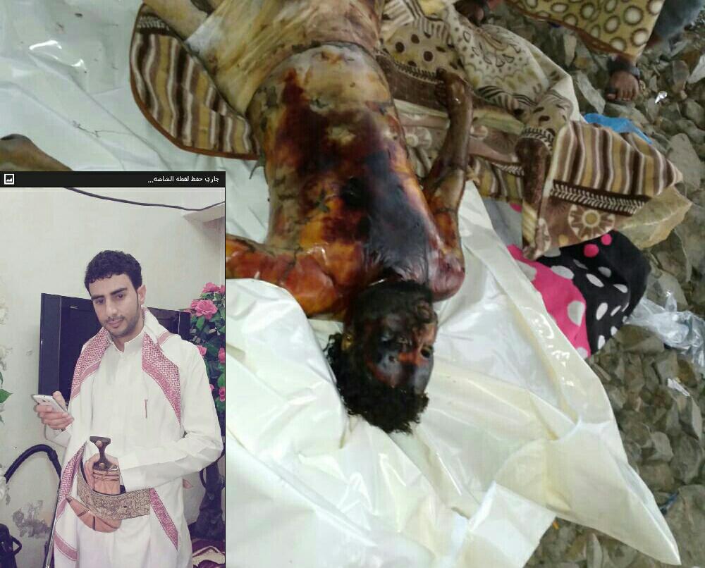 z7371z's tweet photo. رحت الله تغشاك ياعبدالفتاح المليكي رجع من السعوديه فوجداجله في اليمن شهيدالغدروالخيانه https://t.co/btBYFIf0ii