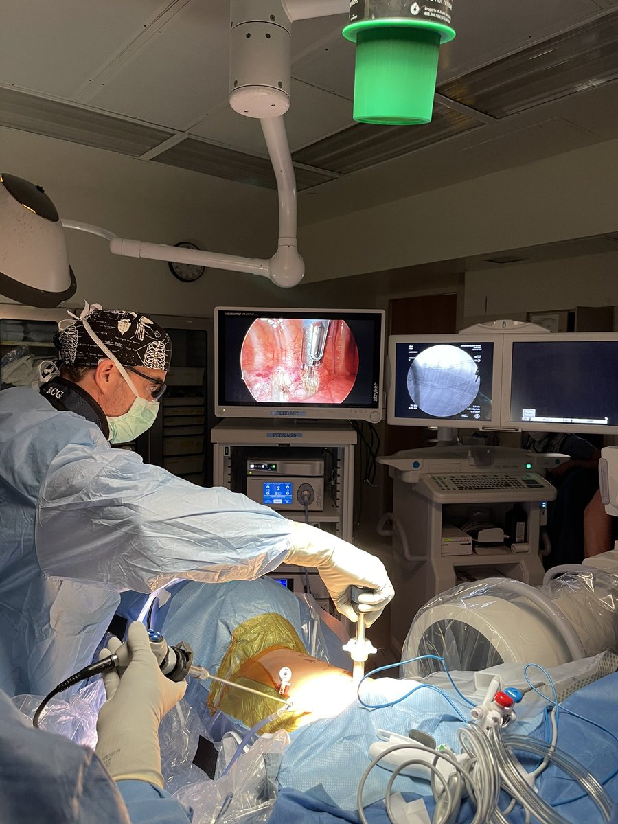 #vbt live action shot from @CleClinicKids @ClevelandClinic vertebral body tethering remains a good option for select growing patients with #scoliosis #scoliosissurgery #orthotwitter #medtwiter #spinesurgery #scoliosiswarrior #tethering #scoliosiswarrior #spinesurgery