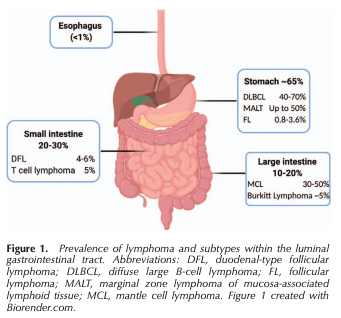ArchivesPath's tweet photo. "Gastrointestinal Tract Lymphomas: A Review of the Most Commonly Encountered Lymphomas" Alvarez-Lesmes et al. #EarlyOnline #gipath #hemepath https://t.co/aEeDw0SPfi https://t.co/rvs7UdkIyi