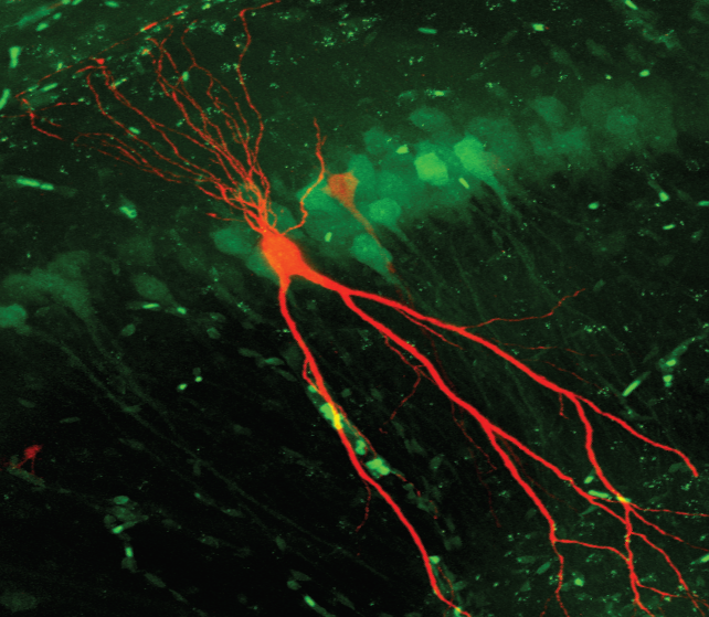 Nicole Calakos PhD MD tweet media