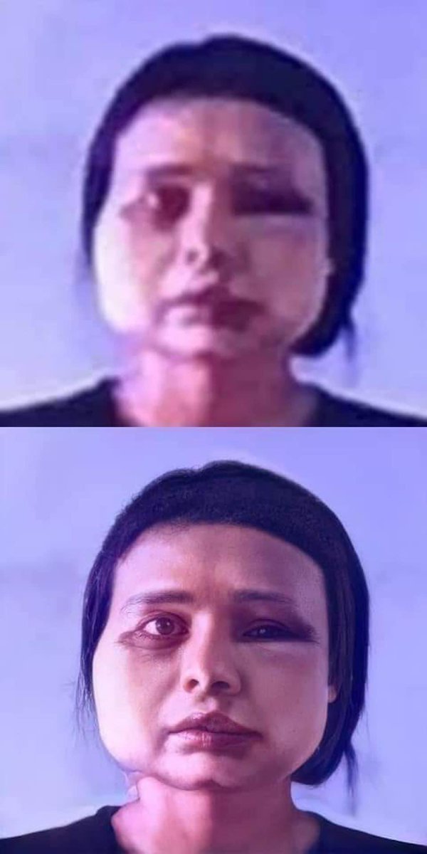 dal_hht's tweet photo. Khin nyein thu, 19 year old, was told to spread her legs and then they hit her female organ to the point where she would bleed. They rode on her shoulders and pulled her hair. We strongly condemn any kind of abuse on our civilians. @SchranerBurgen1 #WhatsHappeningInMyanmar https://t.co/gF7lbkubDU