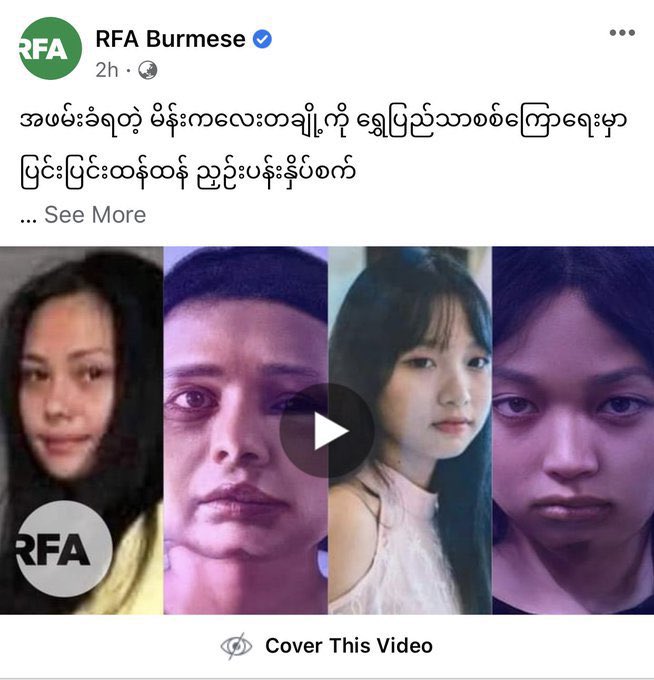 1/3 Ma Khin Nyein Thu has been in detention at Interrogation Center since Apr 18. She was first investigated at 9 miles Interrogation Center then referred to ShwePyiThar IC. She has been brutally TORTURED bruising the whole face. 
#CrimesAgainstWomen 
#WhatsHappeningInMyanmar