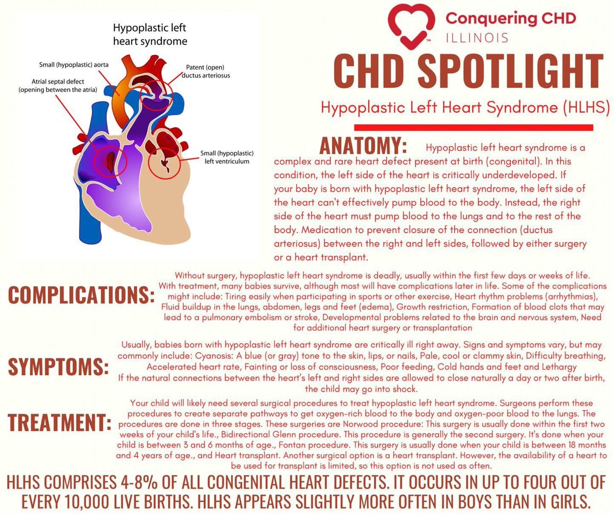 HLHS comprises 4-8% of all congenital heart defects. It occurs in up to four out of every 10,000 live births. HLHS appears slightly more often in boys than in girls. #conqueringchdinil #chdspotlight #chdawareness #spotlight #hlhs #hypoplasticleftheartsyndrome #hlhswarrior