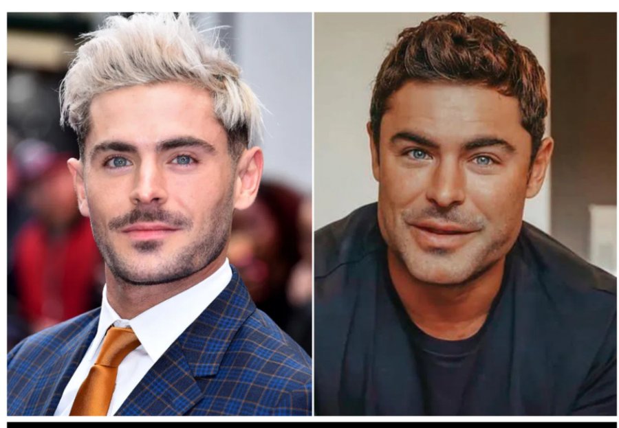 顔の異変 が話題のザック エフロン 整形疑惑に関して友人が 真相 を語る フロントロウ 海外セレブ 海外カルチャー情報を発信