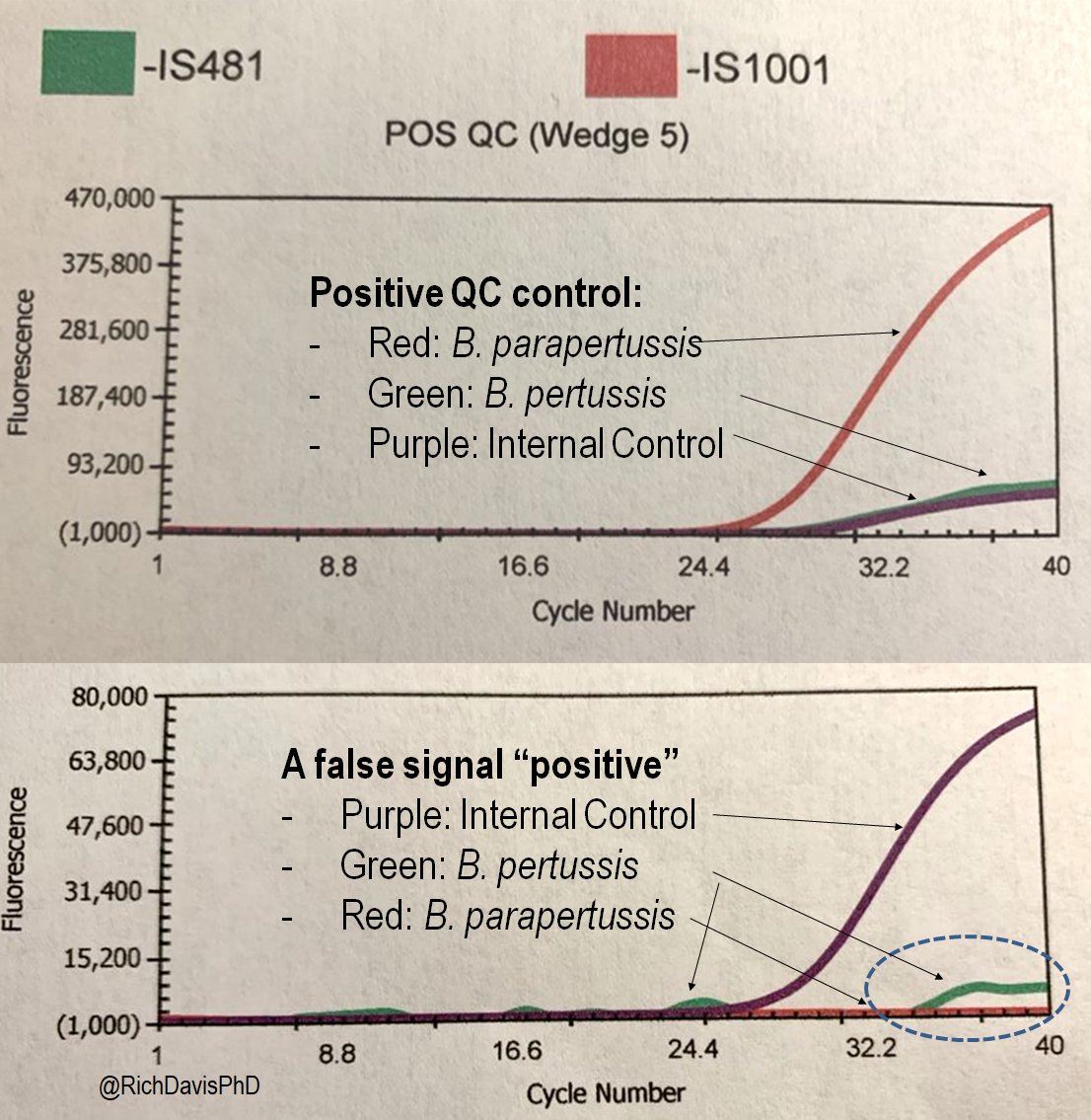 richdavisphd's tweet image. #MicroRounds (Day 848): A last #WhyClinMicroMatters to round out #LabWeek2021.

Bordetella pertussis/parapertussis PCR test. Sample flagged positive for B. pertussis. But a great tech saw the odd amplification curve &amp;amp; low fluorescence. A real positive? #ASMClinMicro #IDTwitter