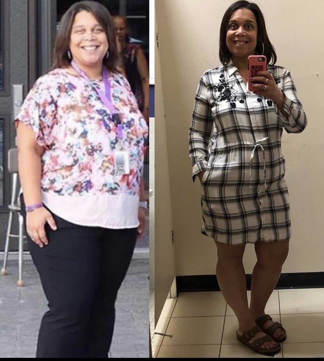 mosterhoudt's tweet photo. I was released from my bariatric surgeon today! No more follow ups. Iโm 2 1/2 years post op. Bittersweet. Feeling strong and healthy at 48. #weightlosstransformation #feelgoodinyourownskin https://t.co/d8lTrjh4IZ