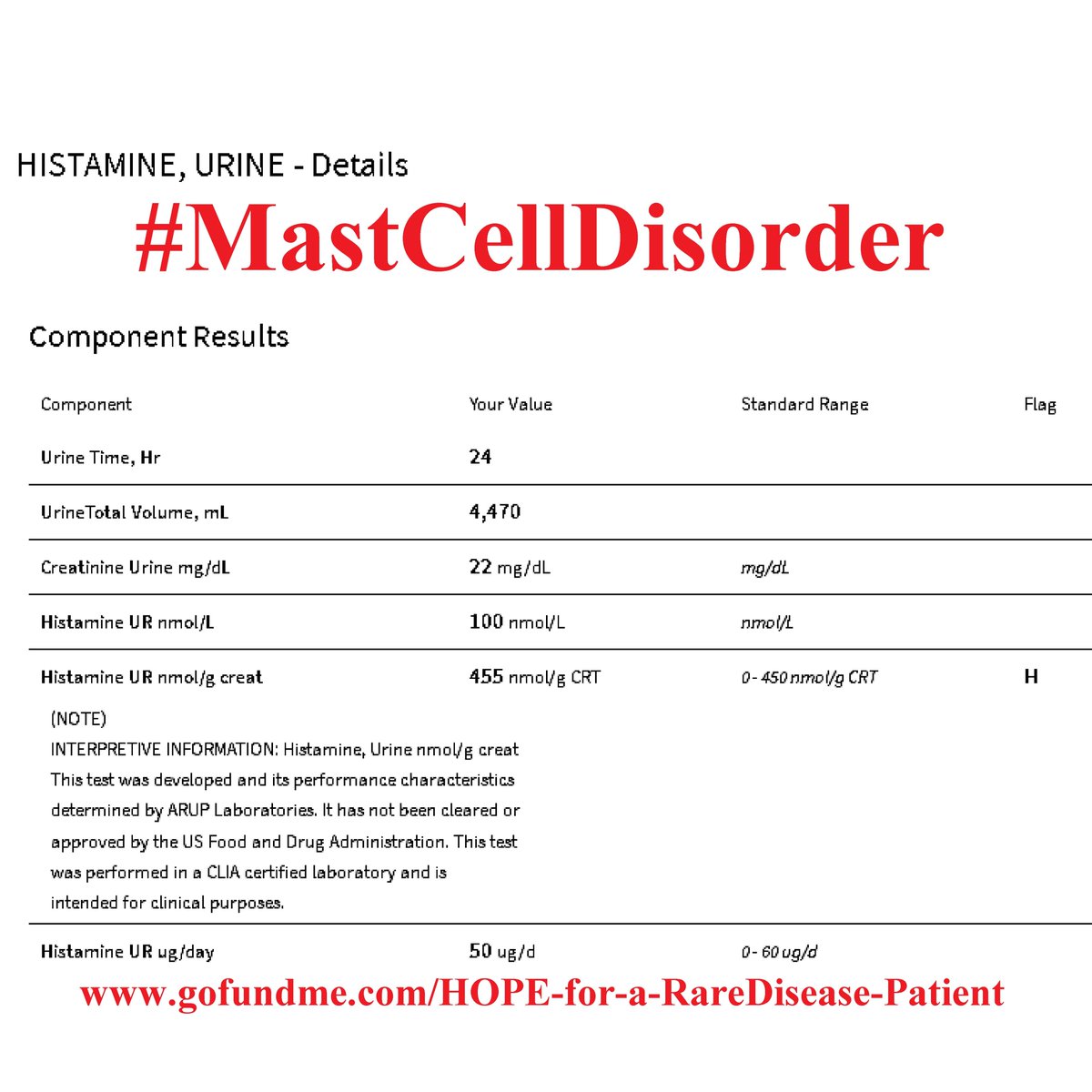 A #24HourUrine #Histamine Test might require two jugs if you have #AddisonsDisease, #PosturalOrthostaticTachychardiaSyndrome, or #EhlersDanlosSyndrome.🥴😳

#Immunology #MastCellDisorder #MastCellDisease #MCAS #MastCellActivation #SystemicMastocytosis

💔gofundme.com/HOPE-for-a-Rar…