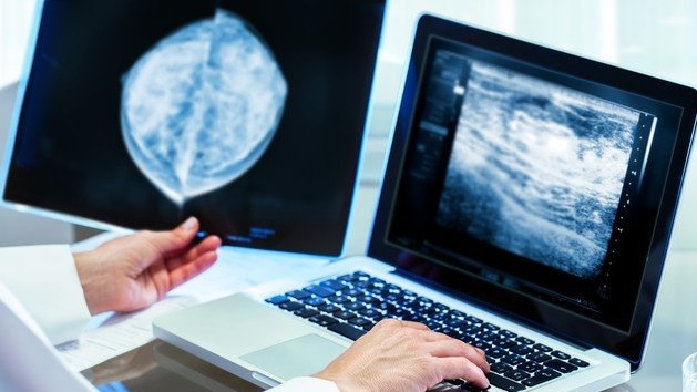 ...il aida aussi la médecine !Comment ? Durant les 3 années où il envoyait des photos floues, les chercheurs avaient élaboré un algorithme pour les rendre nettes. Et cet algorithme fut adapté aux traitements des mammographies pour détecter encore mieux les cancers du sein !