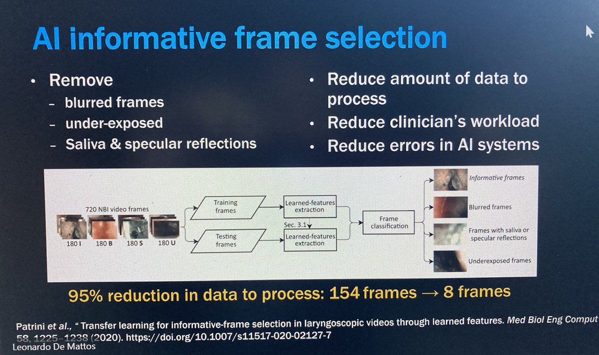petra_jankowska's tweet photo. Fantastic talk from Leonardo De Mattos on AI applications in #HCSN endoscopy 👇🏼#DeepLearning #MachineLearning #AI @EORTC @BAHNOOfficial @MPHRadiotherapy @SomersetIRads @dremmaw https://t.co/ICcdS38G5m
