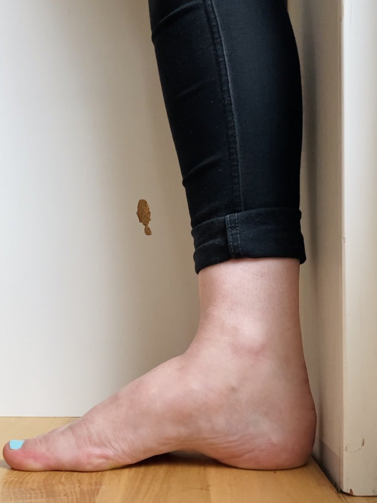 High arch:you’re able to see through to the other side when placing weight on the foot, like this