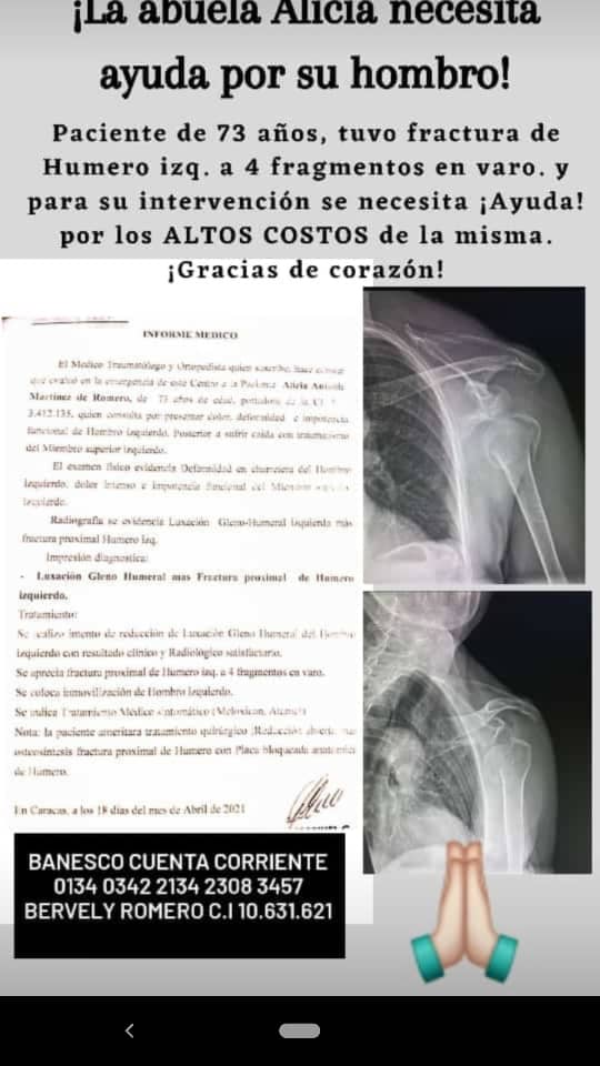 DiarioTalCual's tweet photo. #ServicioPúblico Paciente de 73 años de edad presenta una fractura de humero izquierda y para corregirla necesita ser intervenida quirúrgicamente. Quien pueda ayudar económicamente, favor hacerlo a los datos bancarios que se muestran en la imagen. Gracias. https://t.co/2e9Xs96iOR