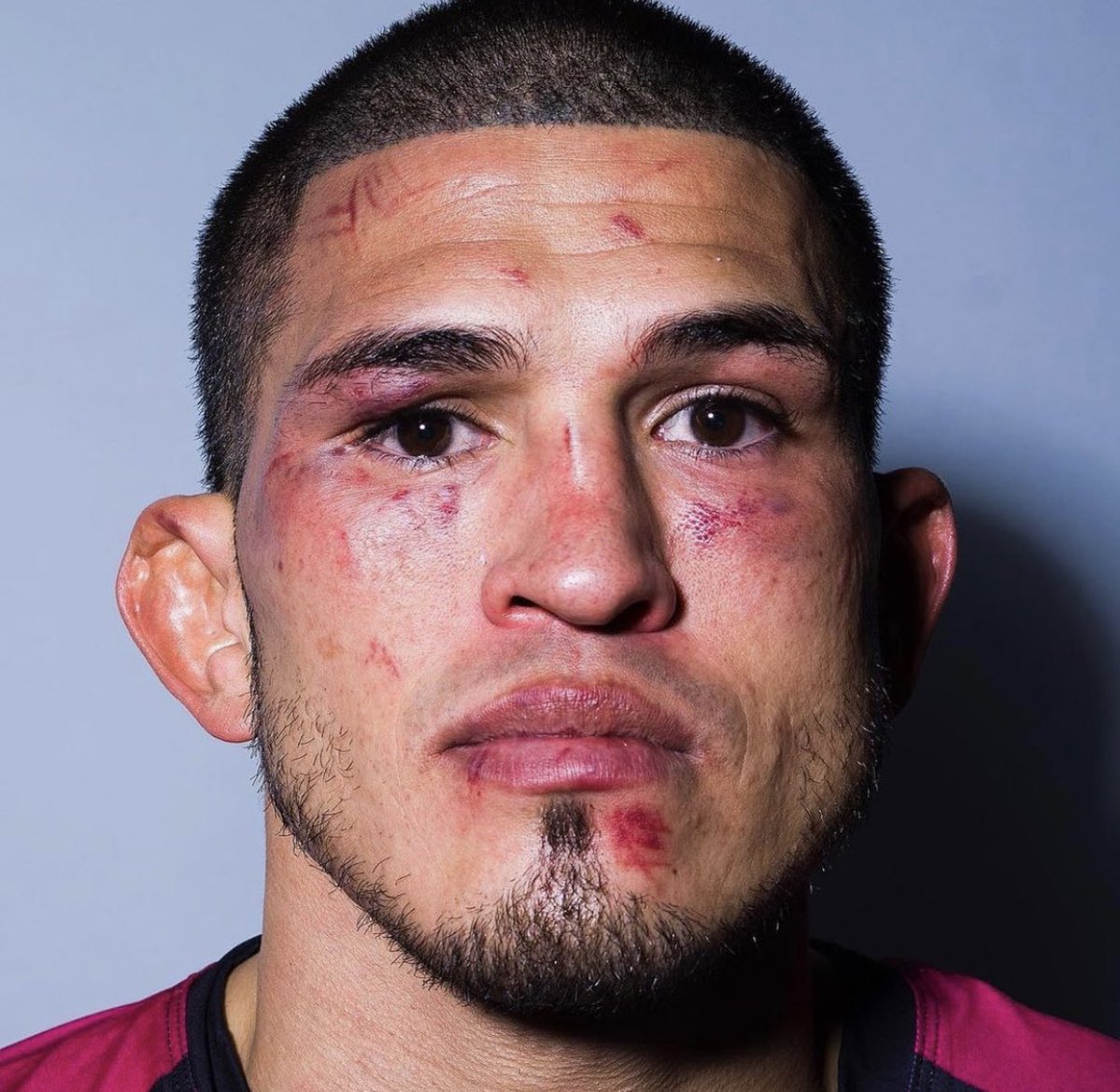 Showtimepettis's tweet photo. No excuses! Great fight @CCCcollard !!! I’ll be back june 10th. Mission is still the same💪🏽 #noinjuries #itsaseason #teampettis 🎥⌚️@PFLMMA https://t.co/owA4BwmGL2