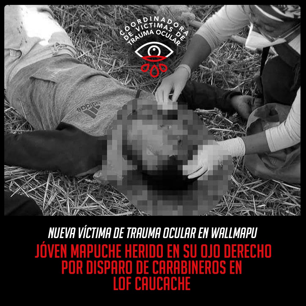 Denunciamos que hoy, sábado 24 de abril, un joven mapuche de 18 años fue agredido por las fuerzas del orden, quienes le dispararon en su ojo derecho. Todo en contexto de una brutal represión en la Araucanía.
Nuevamente, exigimos Disolución y  refundación de las policías!