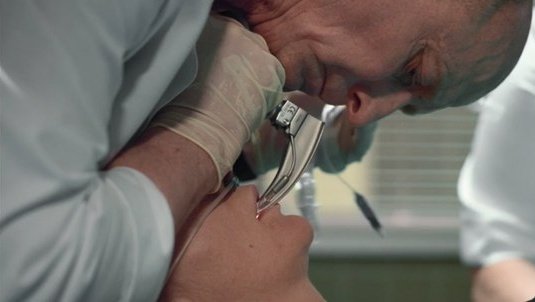 жестк вращ момент. брагин и сергей склифосовский. гинеколог молодой парень. катаплексия доктор хаус 1 сезон. жестк вращ момент.