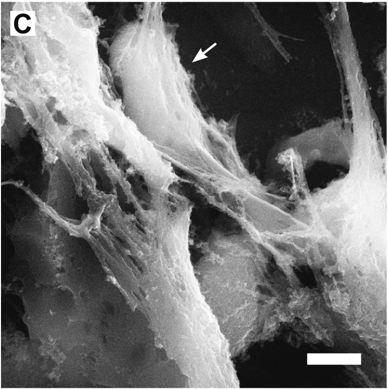 which is to literally vomit their own guts over an intruder in an attack that is usually suicidal, entangling it in DNA. Normally DNA is only found right in the middle of cells where it is working like a computer. But outside cells it's mainly just a sticky spider's web.