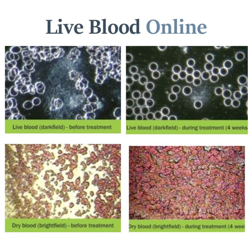 Is your treatment addressing the most important, fundamental issue in the patient’s case? Read our latest newsletter.

linkedin.com/pulse/how-do-y…

#liveblood #livebloodanalysis