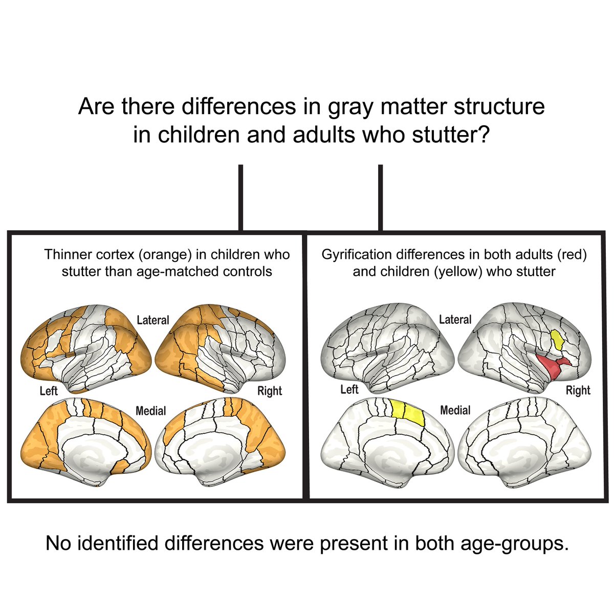 @BrainComms (@braincomms) on Twitter photo Miller et al. report significant correlations between cortical thickness and #stuttering severity in several key speech-planning brain regions in patients with persistent developmental stuttering. <a href="/hilaryemiller/">Hilary Miller</a> <a href="/GuentherLab/">Guenther Lab</a> <a href="/changstutterlab/">Stuttering Research Lab</a> <a href="/BU_Tweets/">Boston University</a> tinyurl.com/4kr29p35 Miller et al. report significant correlations between cortical thickness and #stuttering severity in several key speech-planning brain regions in patients with persistent developmental stuttering. <a href="/hilaryemiller/">Hilary Miller</a> <a href="/GuentherLab/">Guenther Lab</a> <a href="/changstutterlab/">Stuttering Research Lab</a> <a href="/BU_Tweets/">Boston University</a> tinyurl.com/4kr29p35
