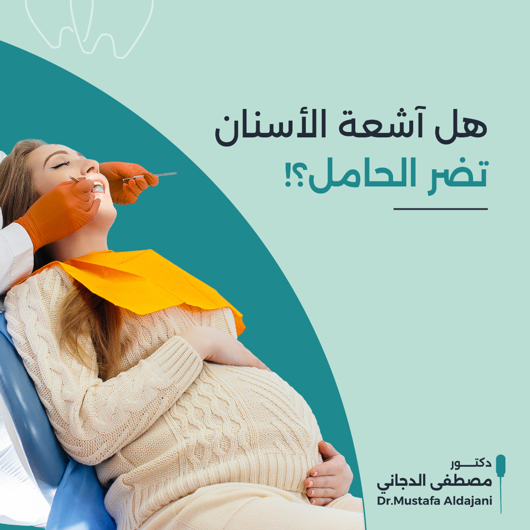 كثير من الحوامل يقلقن بشأن عمل آشعة خوفًا من أنها تسبب ضرر على الجنين، ولكن اطمئني آشعة الأسنان وحتى البنج الموضعي آمنين تمامًا.

#Dr_Mustafa_Aldajani #endodontist #odonto #endo_info #dentistry #oral_health #dentists #dr_mustafa_aldajani #pregnancy #حامل #x_ray