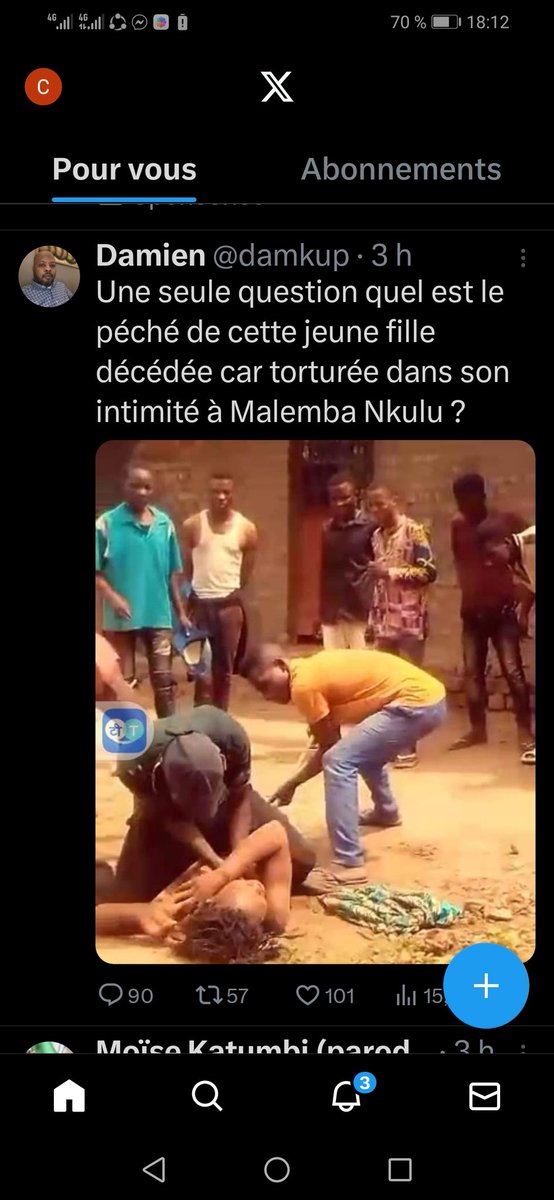 ChadrackMb82974's tweet photo. @KimKimuntu C'est pas lui soyons sérieux la façon dont on a tabasser cette jeune fille, ne peut pas vivre parce que son vagin a était détruire par des sauvages https://t.co/B0P4vIRgDC