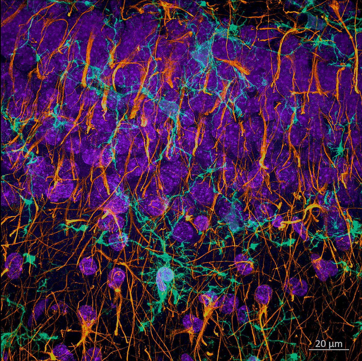DaniBeckman's tweet photo. Happy Wednesday with a zoom on some glial cells in the dentate granular cell layer of the Hippocampus!  🧠🔬 Markers: 🟣Nuclei (Dapi)🟢Microglia (Iba1)🟠Astrocytes (GFAP) @zeiss_micro #neuroscience https://t.co/9buqhZmY6K