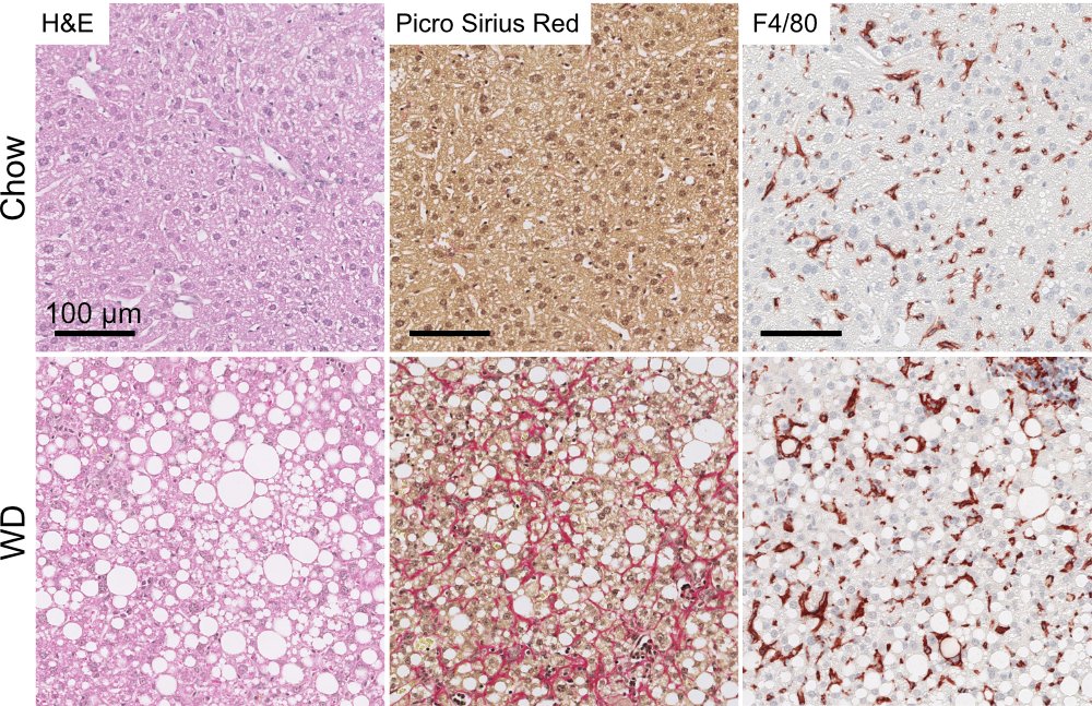 Kim Ravnskjaer (@ravnskjaer_lab) on Twitter photo We first fed mice ๐ญ a pretty bad Western #diet ๐๐๐ฅค for a year and studied their livers. We saw profound changes in genes and proteins related to #inflammation, #fibrosis, #regeneration & #metabolism. Inferred crosstalk between #liver cells was also altered in #MashRoomCafe We first fed mice ๐ญ a pretty bad Western #diet ๐๐๐ฅค for a year and studied their livers. We saw profound changes in genes and proteins related to #inflammation, #fibrosis, #regeneration & #metabolism. Inferred crosstalk between #liver cells was also altered in #MashRoomCafe