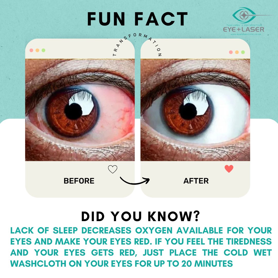 DID YOU KNOW?
LACK OF SLEEP DECREASES OXYGEN AVAILABLE FOR YOUR EYES AND MAKES YOUR EYES RED. IF YOU FEEL TIREDNESS AND YOUR EYES GET RED, JUST PLACE THE COLD, WET WASHCLOTH ON YOUR EYES FOR UP TO 20 MINUTES.