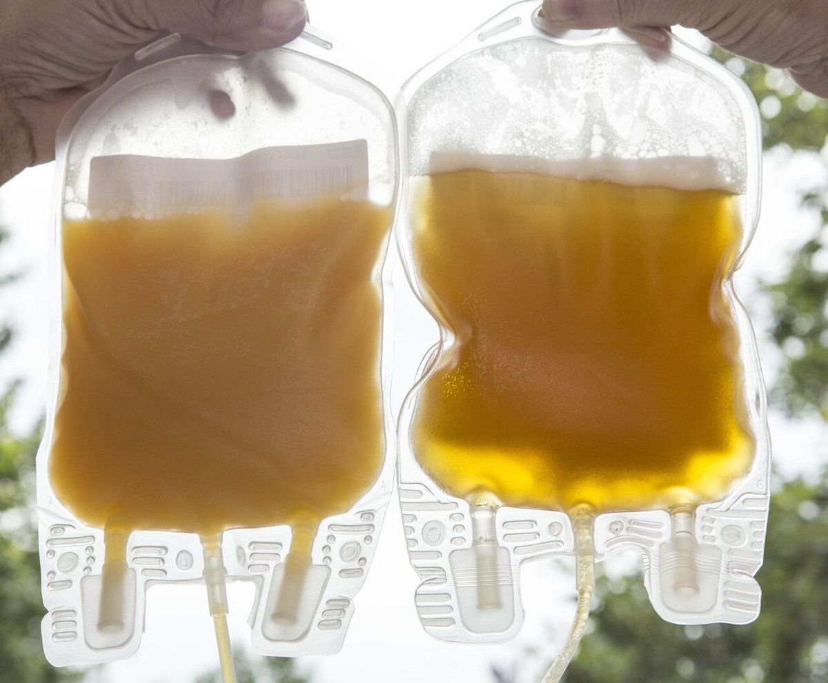 👉 Sabías que...en #plasma, el donante universal es el grupo🆎, aunque todos los grupos son necesarios.

👉 Se obtiene a partir de las donaciones de #sangre o mediante plasmaféresis. 

👉 Se congela a -40º y caduca a los tres años.

👉 Si quieres donar: 91 302 72 40

#donaplasma