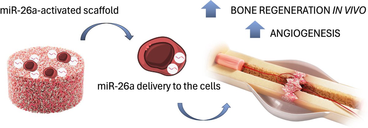 RCSI TERG (@tissueengdublin) on Twitter photo 'Development of miR-26a-activated scaffold to promote healing of critical-sized bone defects through angiogenic and osteogenic mechanisms' is now available to view online! Congratulations to <a href="/jmsadowska/">Joanna Sadowska aka Dr Jojo 🌸</a> and all involved!
View the paper here: sciencedirect.com/science/articl… 'Development of miR-26a-activated scaffold to promote healing of critical-sized bone defects through angiogenic and osteogenic mechanisms' is now available to view online! Congratulations to <a href="/jmsadowska/">Joanna Sadowska aka Dr Jojo 🌸</a> and all involved!
View the paper here: sciencedirect.com/science/articl…
