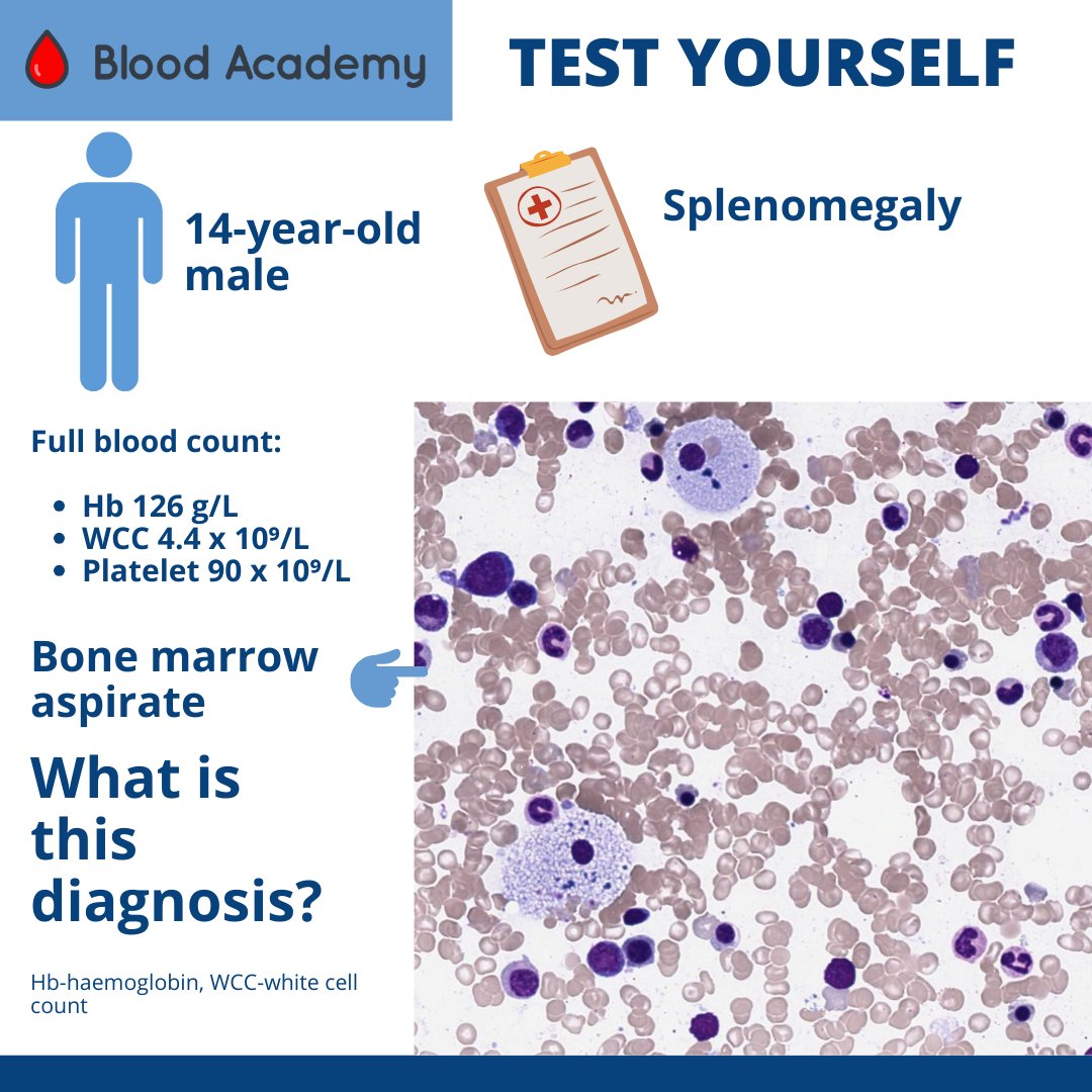 Can you tell what these interesting bone marrow cells are👇 

*Answer tomorrow*

Subscribe today @ blood-academy.com

#hematology #hempath #biomedicalscientist #medicalstudent #medicallaboratoryscientist #morphology #hematology  #biomedicalscientist #ibmschat
