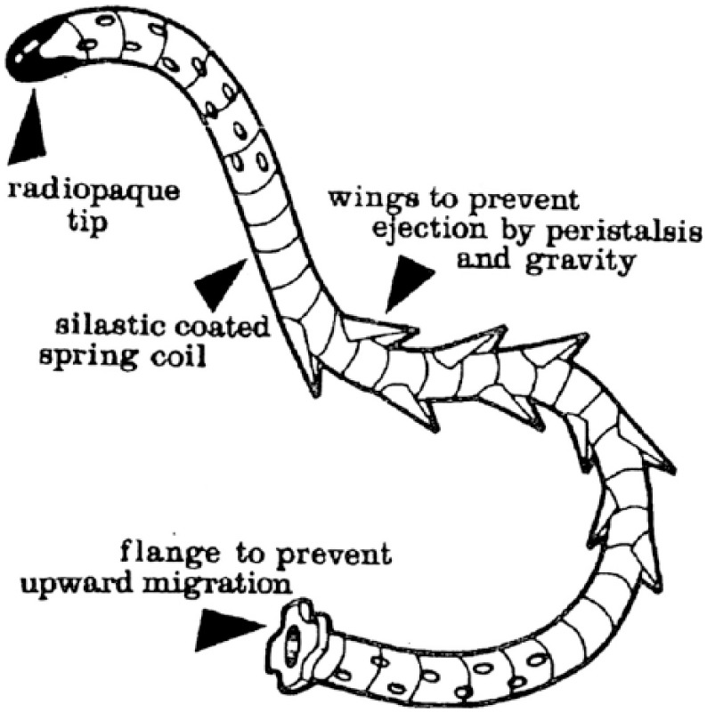 One of the first self-retaining ureteral stents proposed by Gibbons in 1976. 

Despite its intimidating appearance, this stent was actually used in patients. Prior to stent placement, ureter dilation was necessary, and removal could pose challenges. #MedicalHistory #MedHist