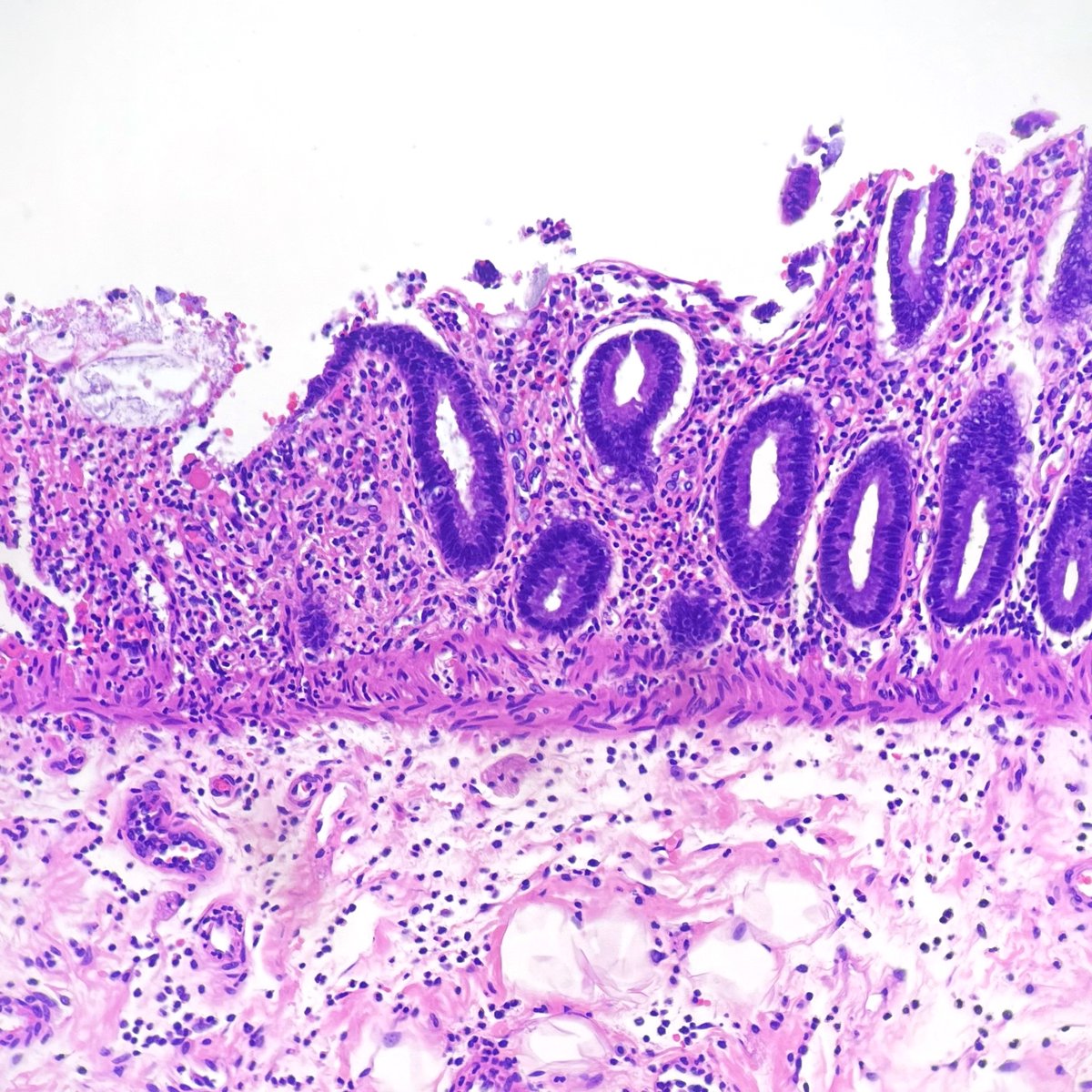 Michael Feely, DO tweet media