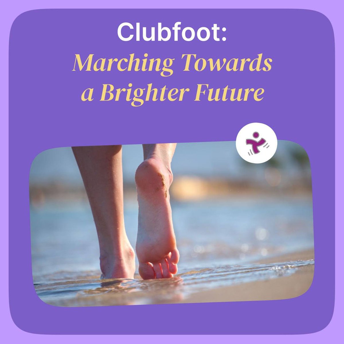 charity_dex's tweet photo. Clubfoot twists feet, causing pain &amp; mobility issues. In 2023, our partner GiveWell granted $5.2M to MiracleFeet for treatment in the Philippines, Chad &amp; Côte d’Ivoire. Support via CharityDEX and help kids walk freely 💜 #ClubfootCare #CryptoForACause https://t.co/w5lZjSlOka