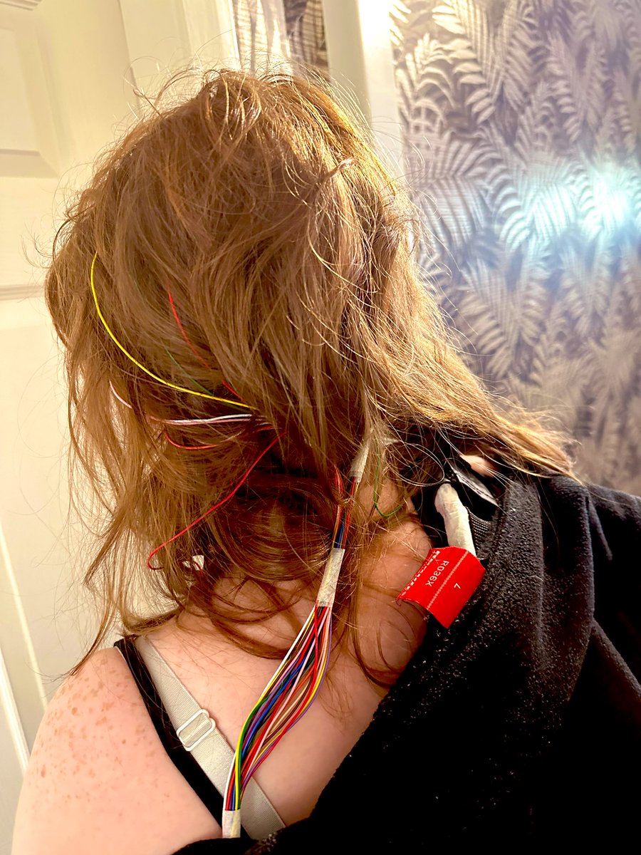 Obv_Delulu_Bex's tweet photo. Today my daughter is having a 24hr EEG. Why? The main use of an EEG is to detect and investigate epilepsy. The electroencephalogram (EEG) is a medical test used to measure the electrical activity of the brain. A number of electrodes are applied to your scalp #EpilepsyAwarenes https://t.co/SkZFEmkNQ0
