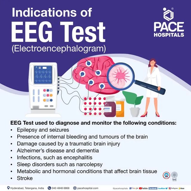 Obv_Delulu_Bex's tweet photo. Today my daughter is having a 24hr EEG. Why? The main use of an EEG is to detect and investigate epilepsy. The electroencephalogram (EEG) is a medical test used to measure the electrical activity of the brain. A number of electrodes are applied to your scalp #EpilepsyAwarenes https://t.co/SkZFEmkNQ0