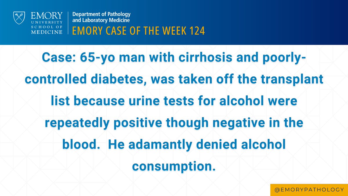 EmoryPathology's tweet image. 🔬EMORY CASE OF THE WEEK #124:  

Contributor: Eileen Burd, PhD

See the image for case details.

#path2path #pathmatch2023 #Pathmath23 #PathTwitter #PathX #EmoryPathRes #EmoryPathology #EmoryCoTW #PathResidents #MedTwitter #MedEd