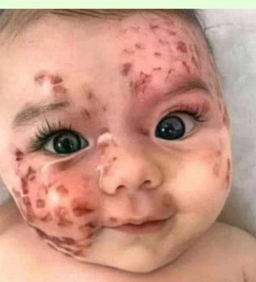 القلوب تبكى  أطفال فلسطين🥺