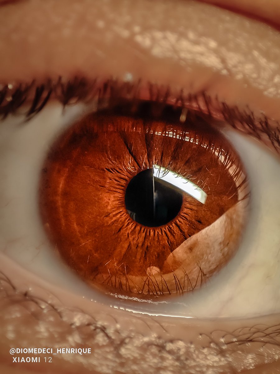 octdiomedeci's tweet photo. Lente macro + Xiaomi 12 Super Macro 
Siga-me no Instagram: https://t.co/dObMbq7wrk

@XiaomiBrasil @Xiaomi @Snapdragon
@snapdragon_BRA @leijun
#Snapdragon #xiaomi #xiaomi12 #Brasil #shots #shotbymi #xiaomiimagery #miuilife #ShotOnSnapdragon #photography #photooftheday #photo https://t.co/jwDhr6DlI9