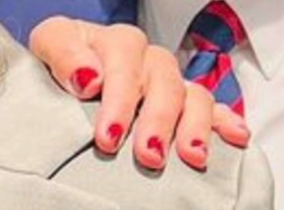 quickbeam71's tweet image. I’m sitting in the orthopedic surgeon’s office sweating bullets bc I’m here to get an injection in my knee. 

#HaplessHal &amp;amp; the #TattyBint seem the remotest of problems…

Anyway, here’s her nail polish at the we-did-not-cut-the-ribbon ceremony in San Diego.