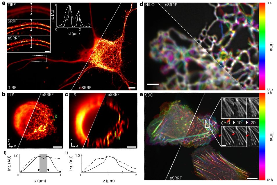 Nature Methods (@naturemethods) on Twitter photo Out today! Enhanced super-resolution radial fluctuations (eSRRF) for improved volumetric live-cell super-resolution imaging at high speeds. <a href="/HenriquesLab/">Ricardo Henriques</a> <a href="/christlet/">Christophe Leterrier</a> <a href="/Bassam_A_HAJJ/">Bassam HAJJ</a> nature.com/articles/s4159… Out today! Enhanced super-resolution radial fluctuations (eSRRF) for improved volumetric live-cell super-resolution imaging at high speeds. <a href="/HenriquesLab/">Ricardo Henriques</a> <a href="/christlet/">Christophe Leterrier</a> <a href="/Bassam_A_HAJJ/">Bassam HAJJ</a> nature.com/articles/s4159…