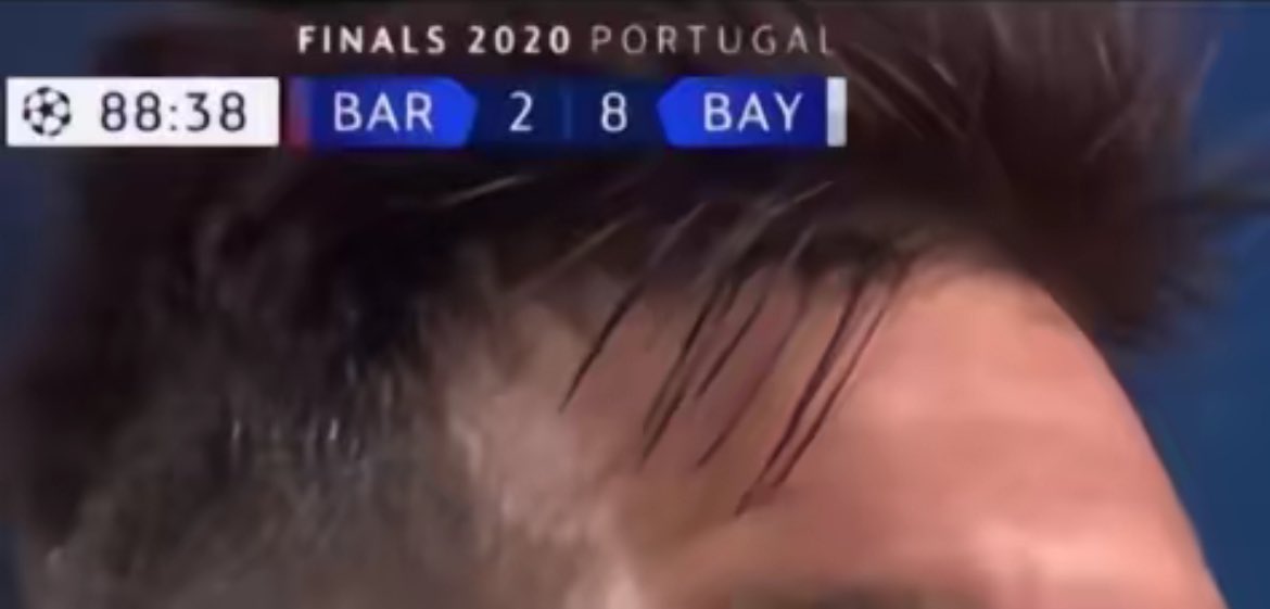 Sabías lo que iba a pasar cuando veías estos peinados.