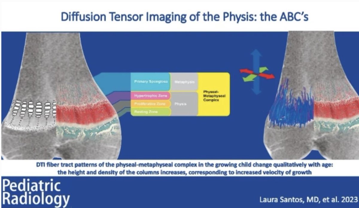 Pediatric Radiology (@pedradjournal) on Twitter photo Now online the November 2023 issue packed with relevant content!
link.springer.com/journal/247/vo…
Topics include physeal imaging, achondroplasia, meniscal tear, AI of fractures, intussusseption, hepatic hemangioma, fatty liver, rapid spine MR
TOC in thread Now online the November 2023 issue packed with relevant content!
link.springer.com/journal/247/vo…
Topics include physeal imaging, achondroplasia, meniscal tear, AI of fractures, intussusseption, hepatic hemangioma, fatty liver, rapid spine MR
TOC in thread