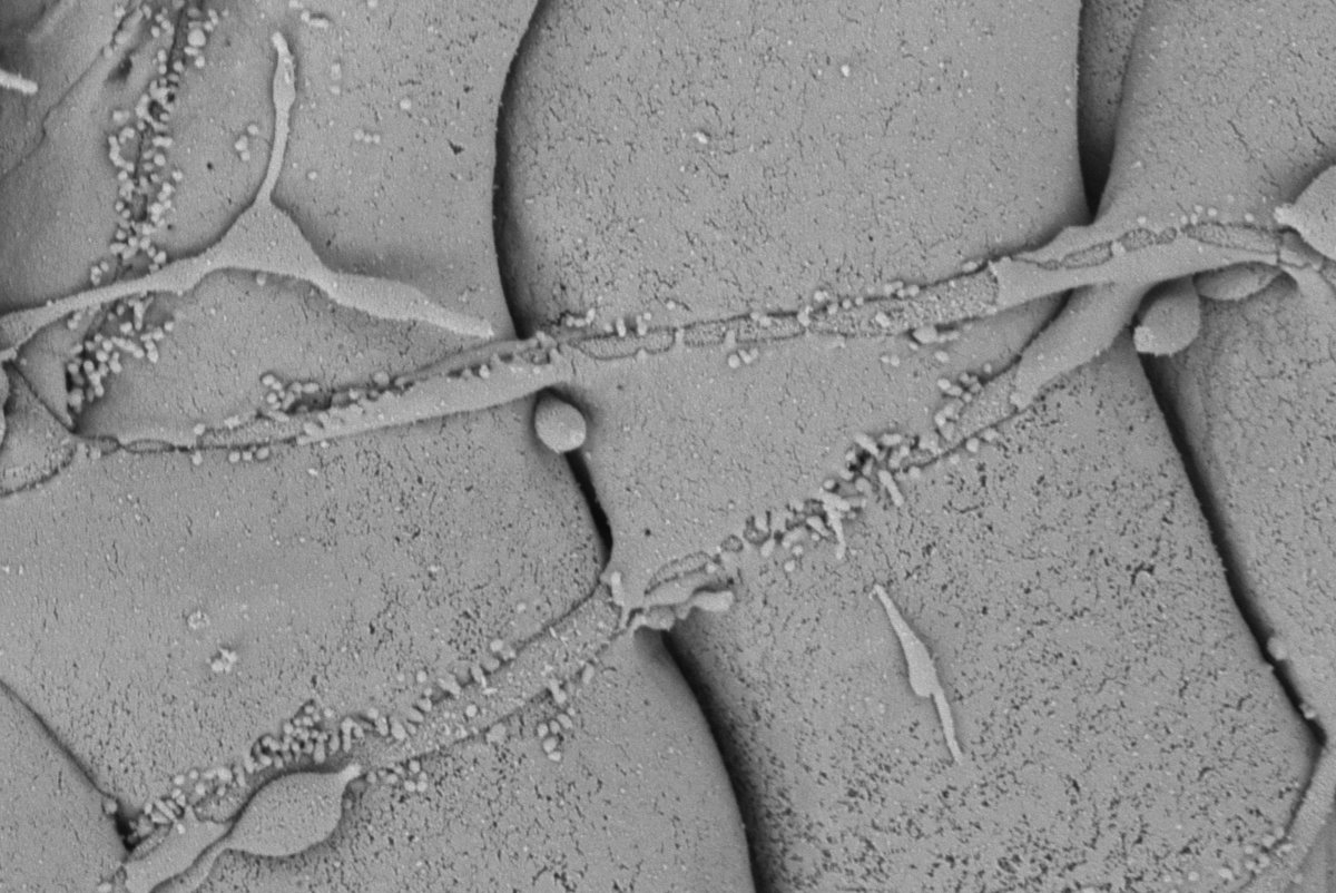 The fibers that innervate the Organ of Corti Outer Hair cells travels radially and adjacently to the Dieter cells (DC) shown here. In fact, these fibers are anchored by DC membranes, which embrace the fibers via short filopodia and flaps.