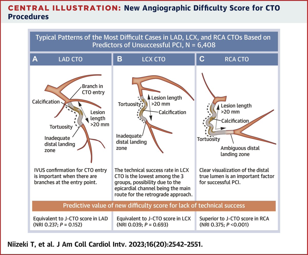 New #JACCINT coronary study evaluated the differences in the predictors of unsuccessful #PCI in first-attempt #CTO lesions of the 3 major coronary arteries compared with the J-CTO (Japanese CTO) score. bit.ly/46lSepz #ACCIntl #CardioTwitter