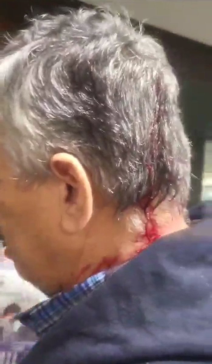 usdtermo's tweet photo. En tan solo una semana militantes kirchneristas acosaron sexualmente a una piba por militar a Milei y le rompieron la cabeza a un jubilado por repartir folletos. Atacan lo que supuestamente dicen defender. El kirchnerismo es fascismo puro y duro. https://t.co/reTMRTYLv0