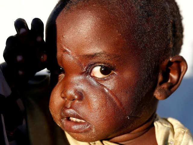 A man in congo have burned himself ALIVE today in order to bring attention to the ethnic cleaning and genocide that have been going on in congo. So let us Spread awareness and let us be their voice since the western media are being really quiet about what been going on in congo🇨🇩