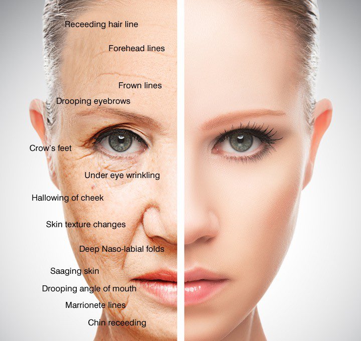 FosterDrugInfo's tweet photo. #Photoaging: Complementary Therapies
#Moisturizers containing
✅#Antioxidants
➤#Niacinamide (#vitamin_B3)
➤#Ascorbic_acid (#vitamin_C)
➤#Coenzyme_Q10
➤#Vitamin_E
➤#Retinyl_esters, #retinol, #retinaldehyde, #oxoretinoids
➤#Alpha_lipoic_acid https://t.co/1M6ox8y9ik
