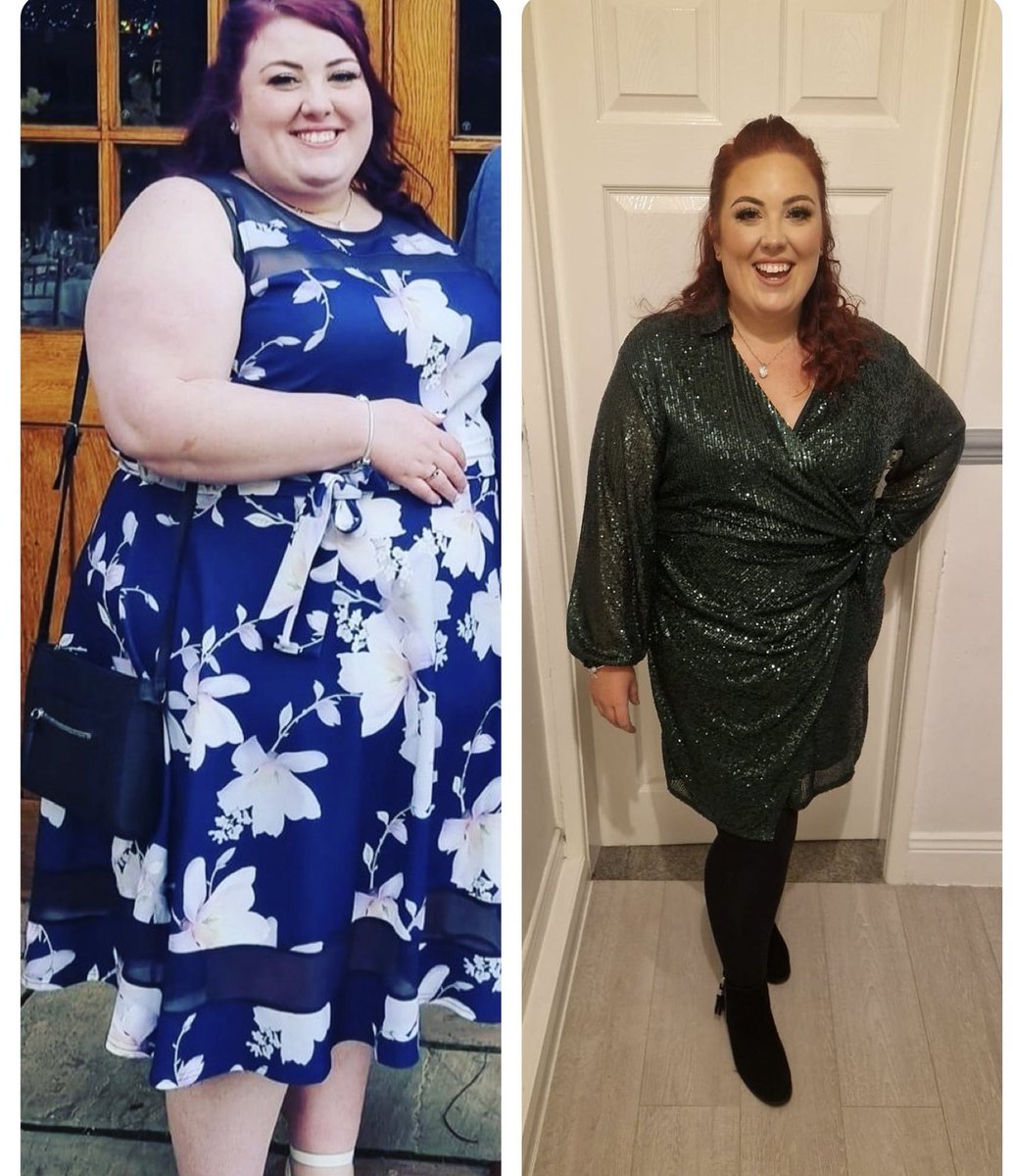 I don’t have often share images from my personal life on here but i’m too proud not too!

8 stone down!

#gastricsleeve #weightlosstransformation #nomorechins #healthierhappierme