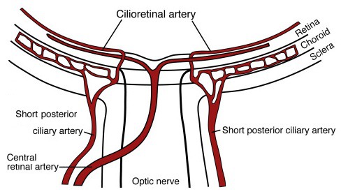 WorldStrokeEd's tweet image. #Mondatip

#Cilioretinal artery is present in ~1/3👁️and frequently supplies the #fovea, critical for central vision
👉Origin: posterior ciliary circulation
☝️when it is present, visual acuity may be ~ normal after a #CRAO, whereas peripheral vision will be severely impaired