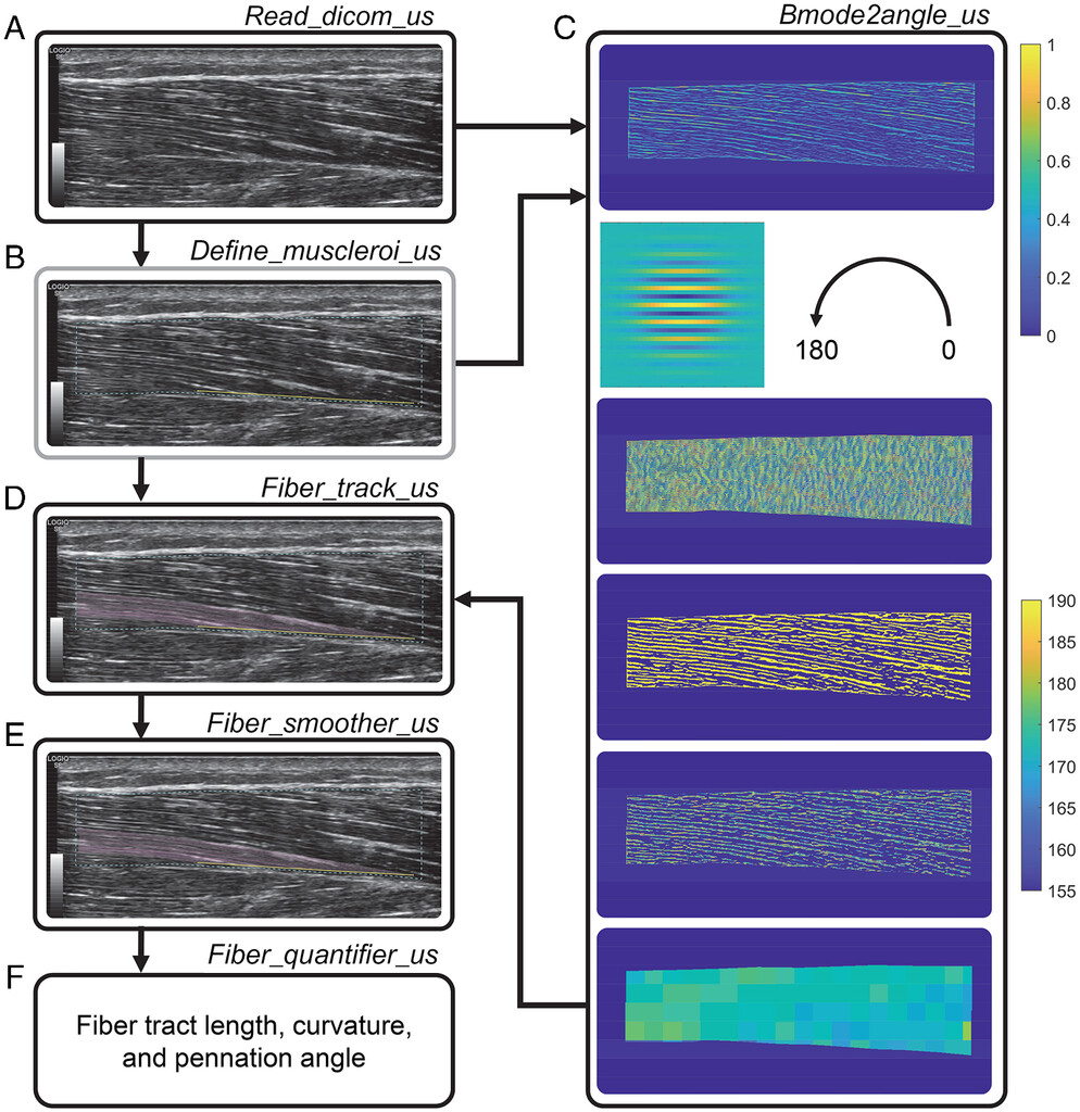 Do you analyze ultrasound imaging data of muscle tissue? 

Check out this new MATLAB toolbox for tracking and mathematically representing muscle architecture at the fascicle scale for brightness-mode ultrasound imaging!

doi.org/10.1123/jab.20…